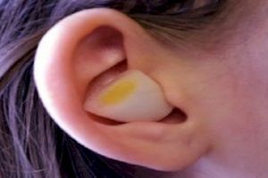 Manfaat menarik dan tak biasa dari bawang putih yang perlu kamu tahu