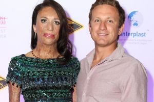 Kisah Turia Pitt, dapatkan cinta sejati meski fisiknya berubah jelek