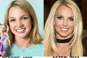 Penampilan 15 selebritis ini jadi menawan setelah operasi plastik