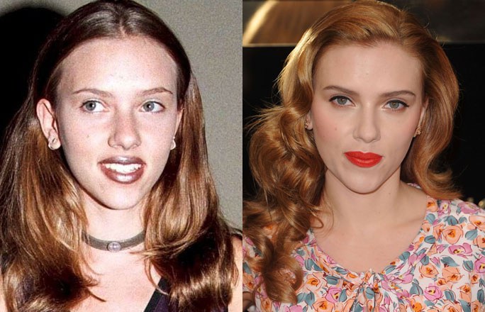 Penampilan 15 selebritis ini jadi menawan setelah operasi plastik