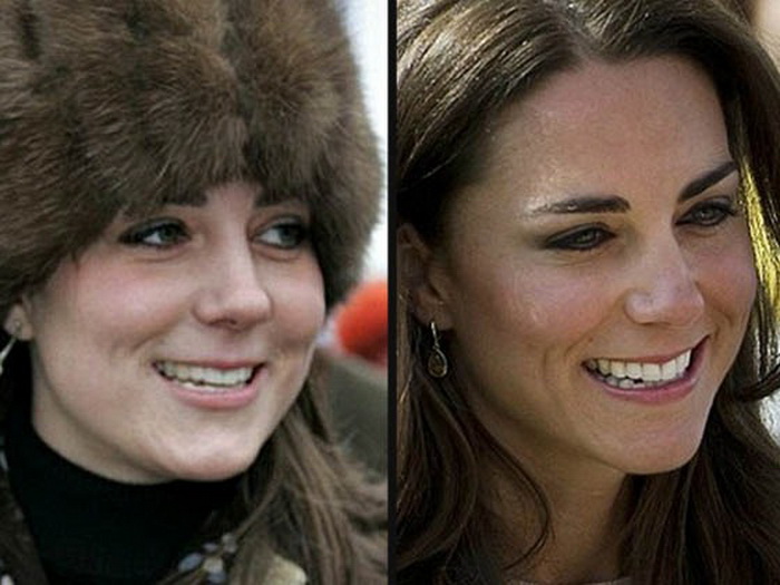 Penampilan 15 selebritis ini jadi menawan setelah operasi plastik