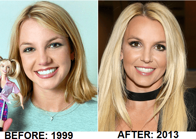 Penampilan 15 selebritis ini jadi menawan setelah operasi plastik