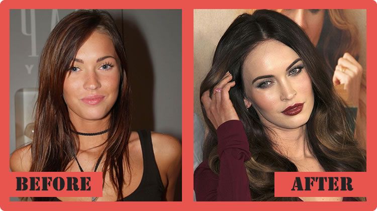 Penampilan 15 selebritis ini jadi menawan setelah operasi plastik