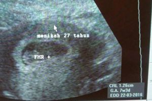 27 Tahun menikah, ibu ini baru diberi kesempatan hamil anak pertama