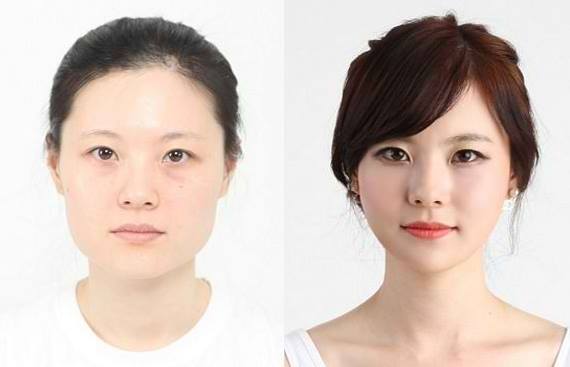 Percayakah kamu 15 foto ini semua hasil operasi plastik?