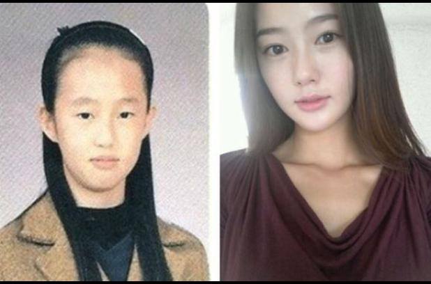 Percayakah kamu 15 foto ini semua hasil operasi plastik?