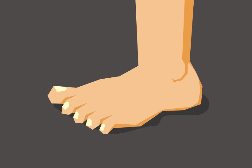 7 Perubahan kaki ini bisa jadi indikasi masalah kesehatan
