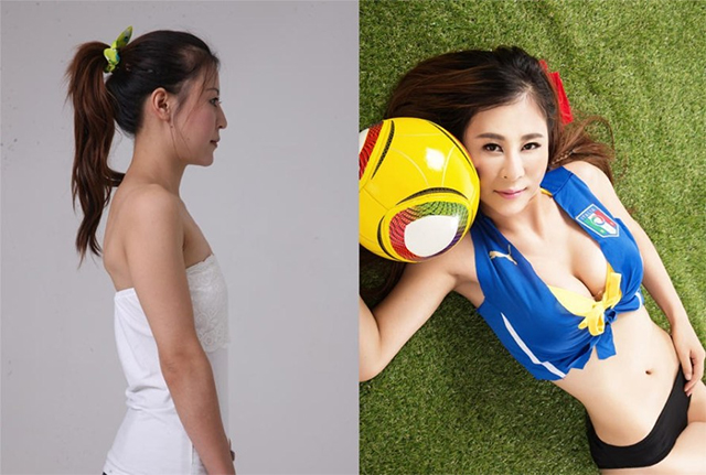 18 Perempuan China ini operasi plastik, bikin pangling!