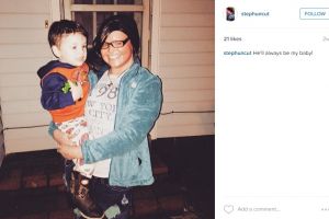 Penyakit langka, perempuan ini punya kelainan kulit, tebalnya 10 cm