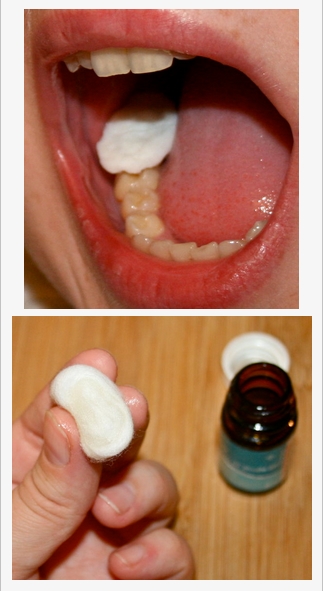 Tips bikin minyak cengkeh untuk atasi sakit gigi