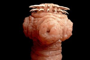 Kerap sakit kepala, ternyata cacing pita bersarang di otak wanita ini