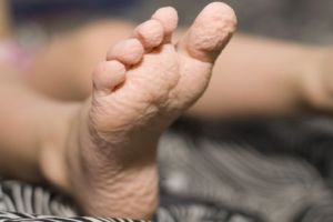 Alasan ilmiah kenapa kulit keriput jika terlalu lama di dalam air