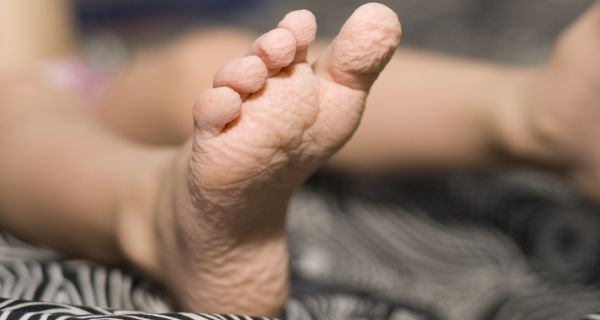 Alasan ilmiah kenapa kulit keriput jika terlalu lama di dalam air