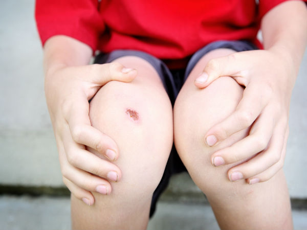 Inilah keampuhan daun sirih selain untuk menginang