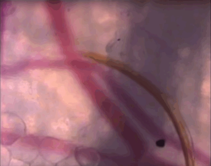 Es batu ampuh hilangkan gatal akibat gigitan nyamuk, benarkah?