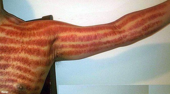 10 Hal ini pasti dilakukan orang Indonesia saat sedang jatuh sakit