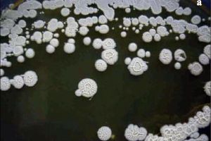 Demi hidup kekal, ilmuwan ini suntikkan 3,5 juta bakteri ke tubuhnya