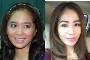 Transformasi Bunga Zainal dari pipi tembem jadi berwajah ala Korea