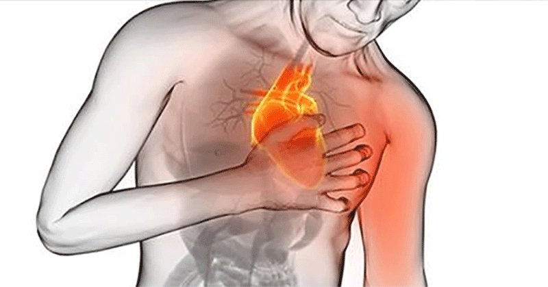 Stroke mengintai kaum muda, mulailah waspada!