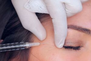Bukan cuma mengatasi keriput, botox juga mustajab sehatkan mata kamu