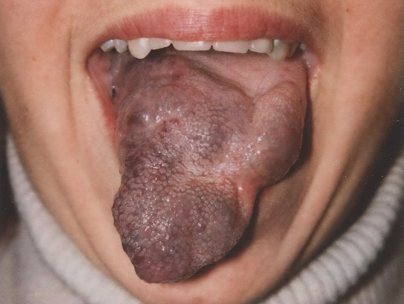 Kumpulan tanda lahir paling aneh, bikin nggak tega melihatnya Kumpulan tanda lahir paling aneh, bikin nggak tega melihatnya