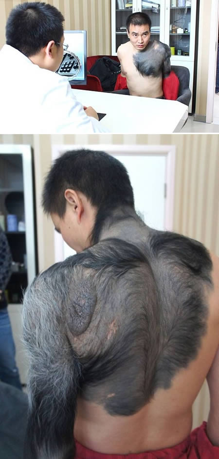 Kumpulan tanda lahir paling aneh, bikin nggak tega melihatnya Kumpulan tanda lahir paling aneh, bikin nggak tega melihatnya