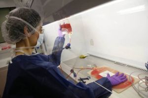 Penelitian terbaru, parasit malaria ternyata juga bisa obati kanker!