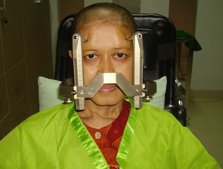 Dewi Yulita, 17 tahun berjuang melawan 5 kanker di tubuhnya