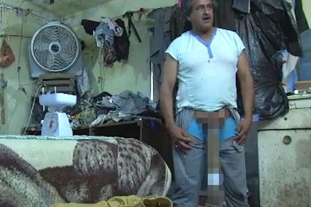 19 Bagian tubuh manusia yang meraih rekor dunia ini bikin kagum