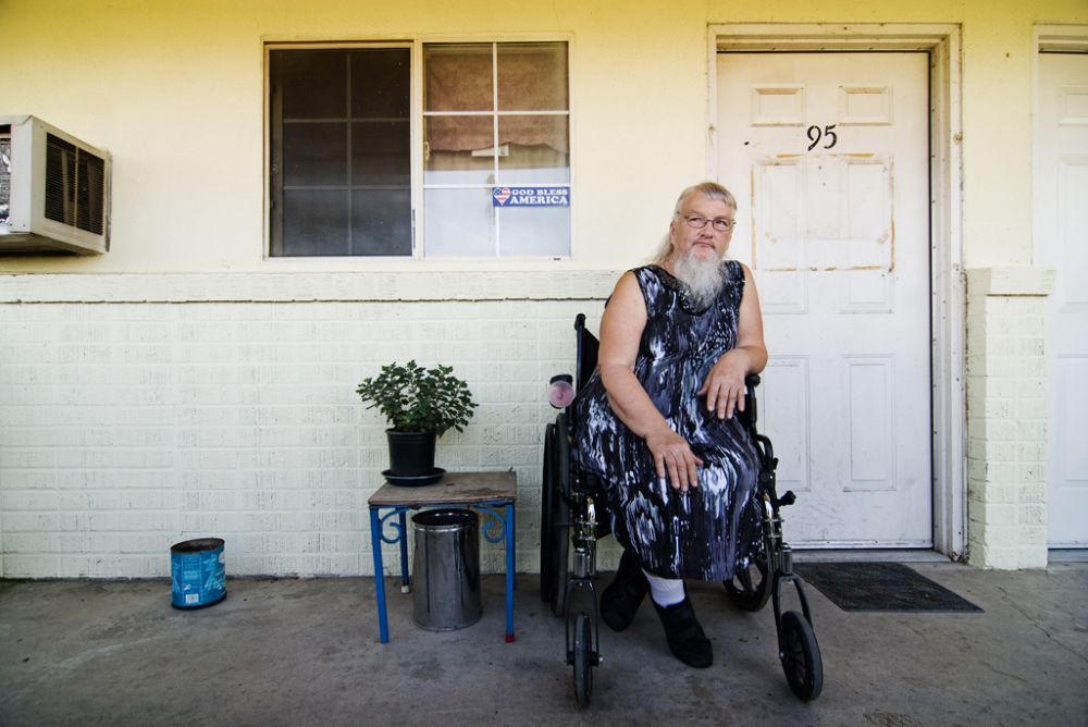 19 Bagian tubuh manusia yang meraih rekor dunia ini bikin kagum