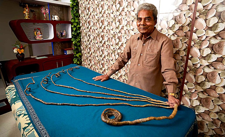 19 Bagian tubuh manusia yang meraih rekor dunia ini bikin kagum