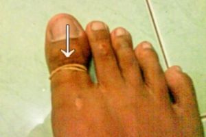 Pengobatan antimainstream ini cuma bisa ditemukan di Indonesia! 