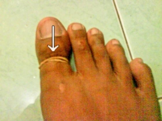 Pengobatan antimainstream ini cuma bisa ditemukan di Indonesia! 