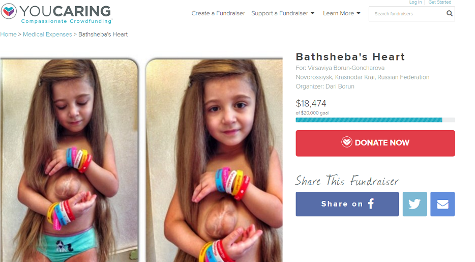 Bocah ini bertahan hidup meski lahir dengan jantung menyembul ke luar