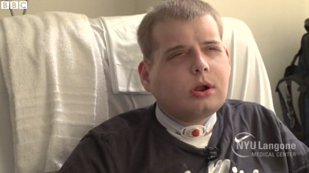 Operasi wajah terluas sepanjang sejarah sukses dilakukan