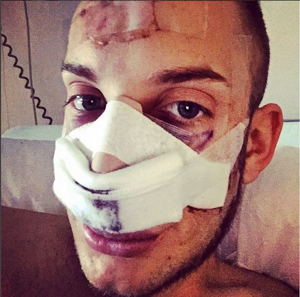 Terobsesi Barbie & Ken, pasangan ini habiskan Rp 4 miliar untuk oplas