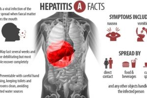 10 Pencegahan penyakit hepatitis A ini wajib kamu ketahui