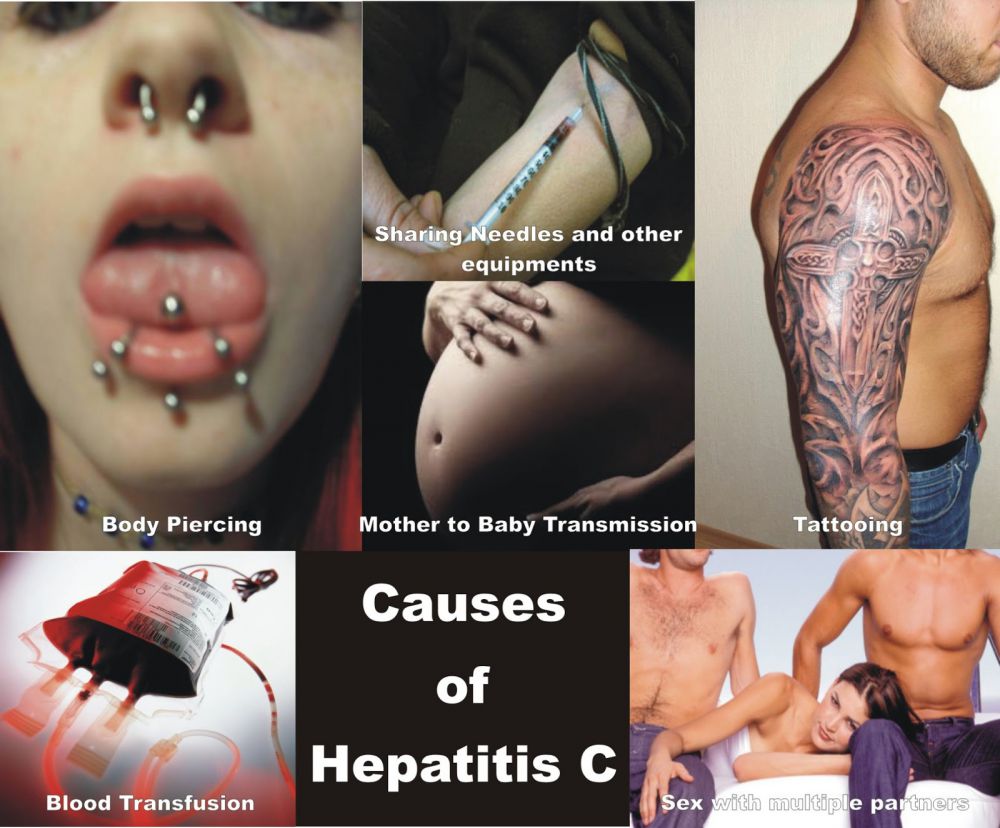 5 Jenis Hepatitis yang wajib kamu tahu, waspadai ya!