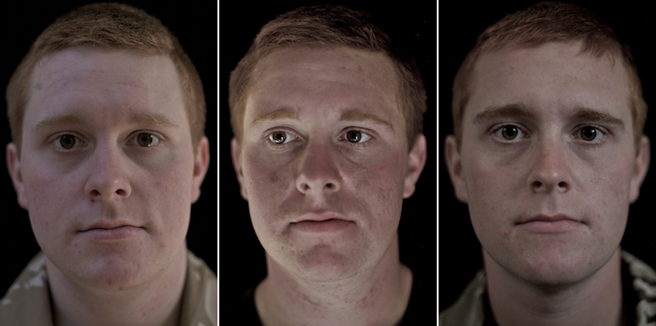 Mencengangkan! Perubahan wajah tentara sebelum, saat, & usai perang Mencengangkan! Perubahan wajah tentara sebelum, saat, & usai perang