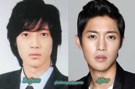 15 Artis Korea ini pernah digosipkan operasi plastik, benarkah?