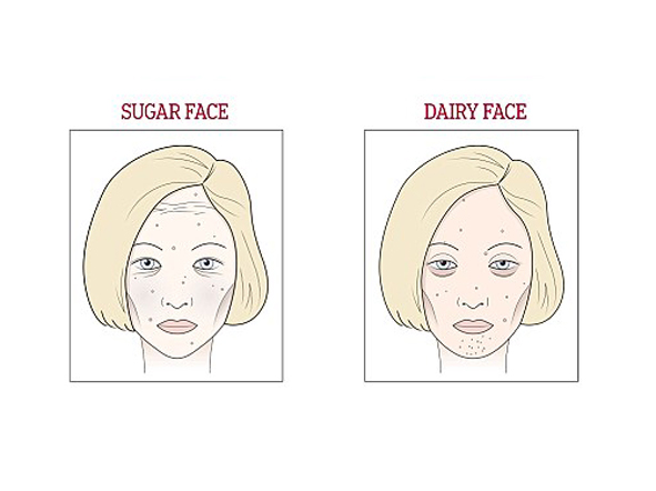 Kulit wajah bermasalah? Batasi konsumsi 4 bahan makanan ini, ladies!