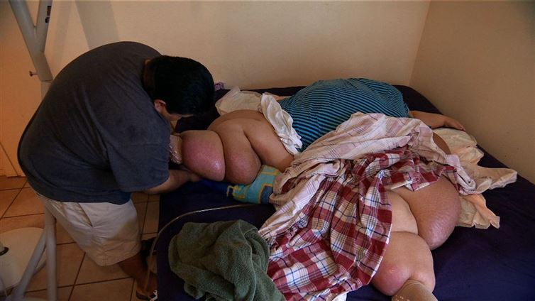 Dulunya berbobot 466 kg, sekarang wanita ini menjelma sosok seksi