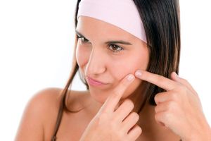 Rajin cuci muka tapi jerawatan? Bisa jadi ketidakseimbangan hormon