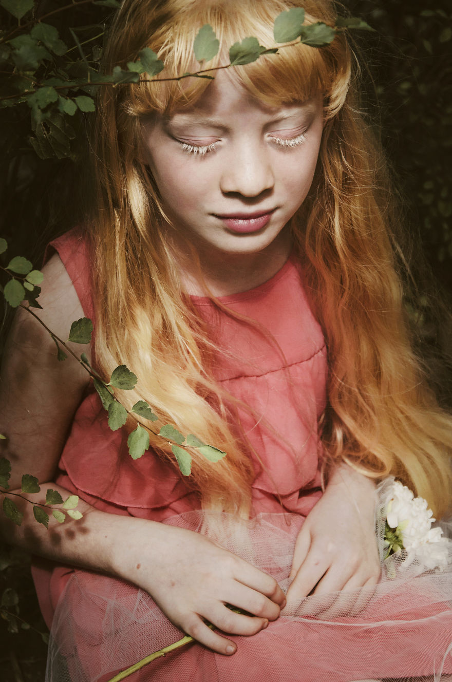  11 Foto eksotik ini bukti gadis albino punya kecantikan alami, wow!