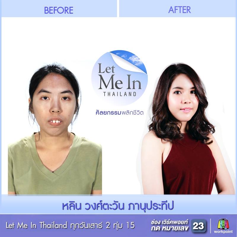 Kamu nggak bakal percaya wanita cantik jelita ini dulunya begini Kamu nggak bakal percaya wanita cantik jelita ini dulunya begini