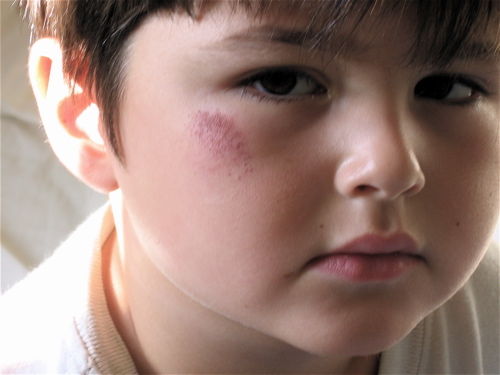 8 Khasiat mouthwash yang tak terduga selama ini, buktikan ya! 8 Khasiat mouthwash yang tak terduga selama ini, buktikan ya!