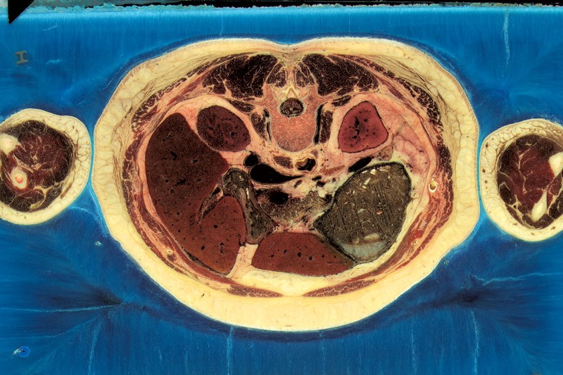Demi lahirnya manusia virtual, tubuh wanita ini dipotong 5000 bagian