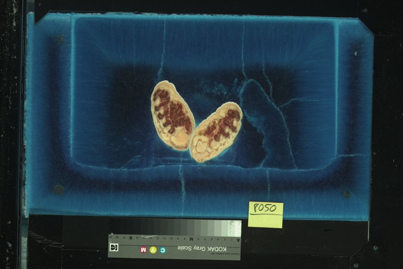 Demi lahirnya manusia virtual, tubuh wanita ini dipotong 5000 bagian