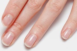 Kondisi kuku tunjukkan kondisi tubuhmu, coba deh perhatikan!