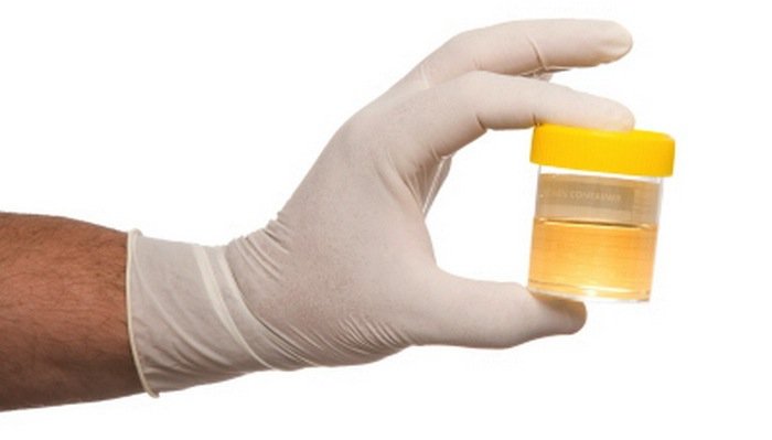 Tiap kali merokok, maka kamu mengirup sianida! Ini zat bahaya lainnya